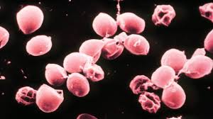 Outbreaks of cryptosporidiosis have been and continue to be reported in several countries. Lancashire Water Cryptosporidium Still Present In Supply Bbc News