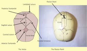 Image result for Vacuum Caput