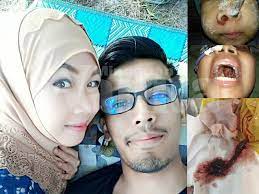 .semua pesakit kanser, saya adalah pesakit kanser tahap 4 dan saya masih boleh lagi berdiri di sini dan kita boleh buat apa yang kita nak kalau kita kuat dan elyana yg kita kenal happy2, ceria2, rupanya menghidap kanser tahap 4, tp nampak bertenaga kerana…. Kanser Lymphoma Tahap 3