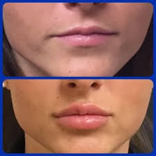 9 Lips ideas