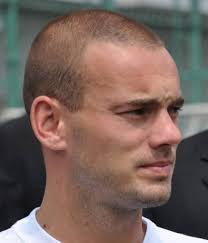 People balding in their 20s