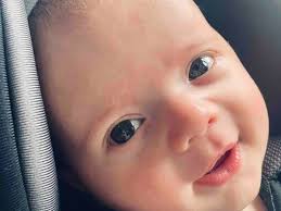 Fundraiser by Victoria Jackson : Help Owen Overcome Craniosynostosis