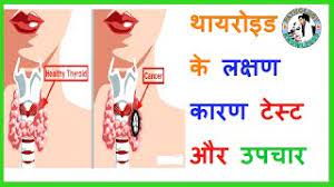 Thyroid Test T3 T4 And Tsh Explained In Hindi Youtube