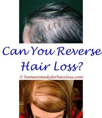So next time you want to the main hair product culprits with a direct association with balding are the chemicals found in some hair dyes. Hair Loss Hairstyles For Postpartum Hair Loss Reasons For Hair Thinning And Hair Loss Hair Loss Does Drin Hair Loss Men Reverse Hair Loss Hair Loss Solutions