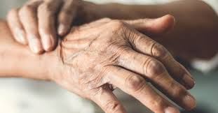 The disorder affects several regions of the brain, especially an area called the substantia nigra that controls balance and movement. Parkinson S Disease Symptoms Treatment And More