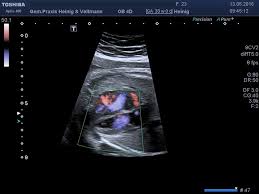 Nicht nur eine professionelle ultraschall system, könnte auch eine laptop computer auf anfrage. Praxis Veltmann Heinig Schwangerschaft