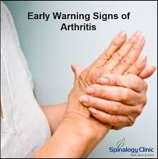 Pin On All About Arthritis