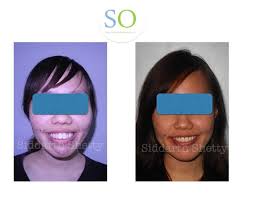 Siddarth Shetty (@shettyorthodontics) • Instagram photos and videos