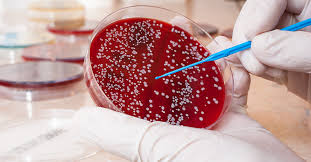 Check spelling or type a new query. Breakthroughs In Blood Cancer Treatments Ctca