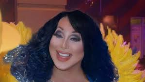 Fundraiser by Patty McGroin : Help Mini Minerva (Gabe) Recover from Fire