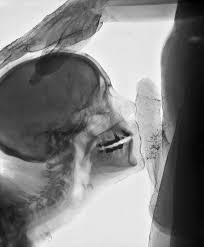 рентген » ВНИМАНИЕ! Голые телки — русские жены и красивые модели и покажут  вам все.