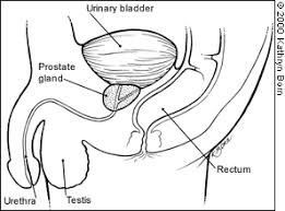 Just a couple of decades ago, before the psa test and regular screening became widespread, most men didn't know they had prostate cancer until it was often too late. Prostatitis What It Is How To Cure It American Family Physician