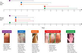 Experts in the us say there have been 12 cases where. Cutaneous Reactions Reported After Moderna And Pfizer Covid 19 Vaccination A Registry Based Study Of 414 Cases Journal Of The American Academy Of Dermatology