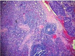 Gelatin capsule,pullulan capsule,hpmc capsule,enteric capsule,fis domestic market, north america, northern europe, western europe Tumor Mass Preparation Capsulated Splenic Parenchyma S Contains Download Scientific Diagram
