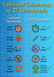 See full list on mayoclinic.org Colonoscopy Vs Ct Colonography Which Is Right For You