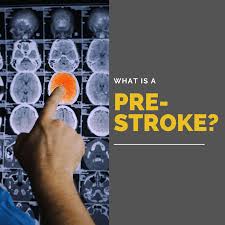 A stroke can cause movement problems, p. What Is A Pre Stroke Premier Neurology Wellness Center