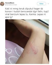 Suaminya sendiri bekerja di sebuah perusahaan besi baja di luar kota. Foto Kerana Fatin Afeefa Wanita Ini Dakwa Teruk Dipukul Suami