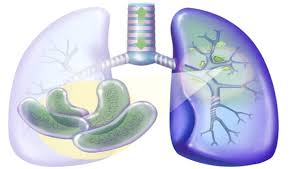 Tuberculosis (tb) is a potentially serious infectious disease that mainly affects the lungs. ÙƒÙŠÙ Ù†ÙØ±Ù‚ Ø¨ÙŠÙ† Ø§Ù„Ø³Ù„ Ø§Ù„ÙƒØ§Ù…Ù† ÙˆØ§Ù„Ø³Ù„ Ø§Ù„Ù†Ø´Ø·