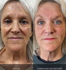 Redefining aesthetics and wellness