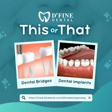 D’Fine Dental Penang• 槟城牙科诊所 -Implant植牙, Veneer牙贴面,Aligner隐形牙套, SmileMakeover微笑改造, Crown Bridges牙冠牙桥(Dr. Kher Yee 张牙医)