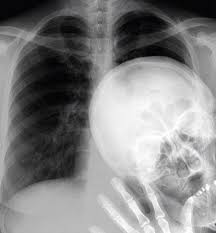 The Chest X Ray Photobomb Medical Humor Make Me Laugh Humor