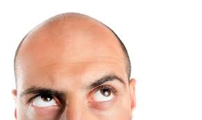 See full list on bidadari.my 6 Punca Rambut Gugur Hello Doktor