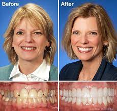 Cosmetic dentistry refers to a range of dental procedures used to restore damaged teeth or replace missing teeth. Cosmetic Dentistry Dr Curtis Kaiser College Station Tx