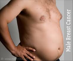 In its early stages, breast cancer may not cause any symptoms. Diagnosis Signs And Symptoms Of Male Breast Cancer
