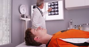 Image result for Concussion Grading
