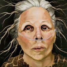 Surreal portrait of mother with cancer
