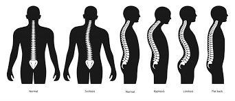 Benefits of proper posture include: How To Improve Your Posture My Family Physio