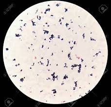 It gets its name from the danish bacteriologist hans christian gram who first introduced it in 1882, mainly to identify organisms causing pneumonia.1 often the first test performed, gram staining involves the use of crystal violet or methylene blue as the primary color.2 the term for organisms that retain the. Hemocultured Smear Of Gram Positive Cocci In Cluster Bacteria Under Stock Photo Picture And Royalty Free Image Image 92662996