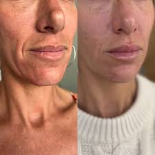 Danielle Mathers, RN, BSN, CANS