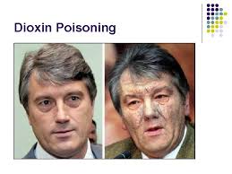 Later, dioxins were found in times beach, missouri and love canal, new york and seveso, italy. Toxicology Toxicology The Study Of How Natural Or