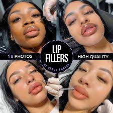 Microneedle Lips
