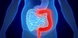 Que Es La Colitis Ulcerosa Sintomas Causas Y Como Tratar La Enfermedad