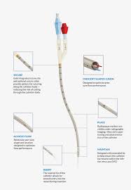 Crescent Jugular Dual Lumen Catheter