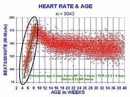 A few terms you might need to know are bradycardia and tachycardia. Heart Rate Wikipedia