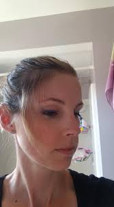 Hair loss in the hairline products and supplements?