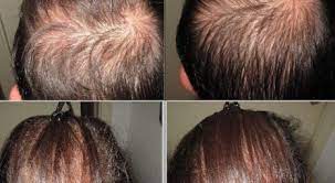 How to walk the talk of diversity, equity, and inclusion it’s easy to view the corporate world’s growing emphasis on dei—diversity, equity, and inclusion—with cynicism. Ormoni E Caduta Dei Capelli Quale Correlazione Poliambulatorio Medico Chirurgico Filippini