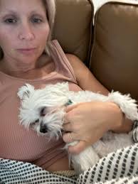 How to find a surgeon for breast implant removal and capsule removal?