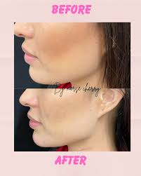 Ruth Ann Cherry RN, BSN