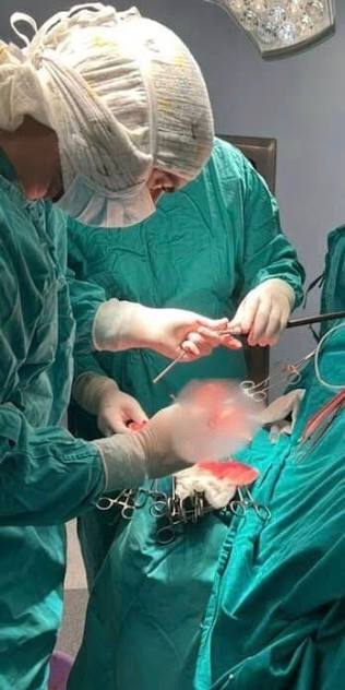PRVA OPERACIJA TUMORA NA MOZGU U DOBOJSKOJ BOLNICI