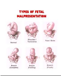 Image result for Face Presentation