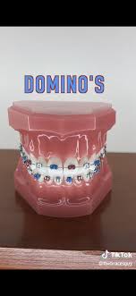 If you want to know how to brush in the meantime, braces will make brushing your teeth a little more complicated. Fast Food In 2020 Cute Braces Cute Braces Colors Braces Colors