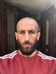 It is mostly caused by genes, allergies and other diseases like diabetes type 1. How To Cope With Going Bald Before You Re Ready To Dazed Beauty