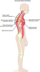 Pin On Posture