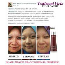 Masker alami yang dapat dicoba. Jeragat Degil Pudar Dalam Sebulan Adaa Inspiration