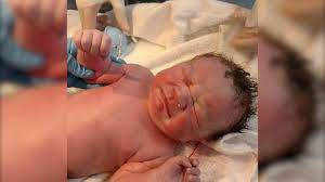 For a look into estimated costs, check out our birth control cost chart here. Mirena Baby Photographed Clutching His Mother S Iud After Birth National Globalnews Ca