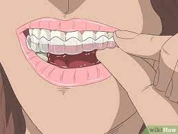 How to brush your teeth with braces wikihow. 3 Ways To Take Care Of Your Braces Wikihow
